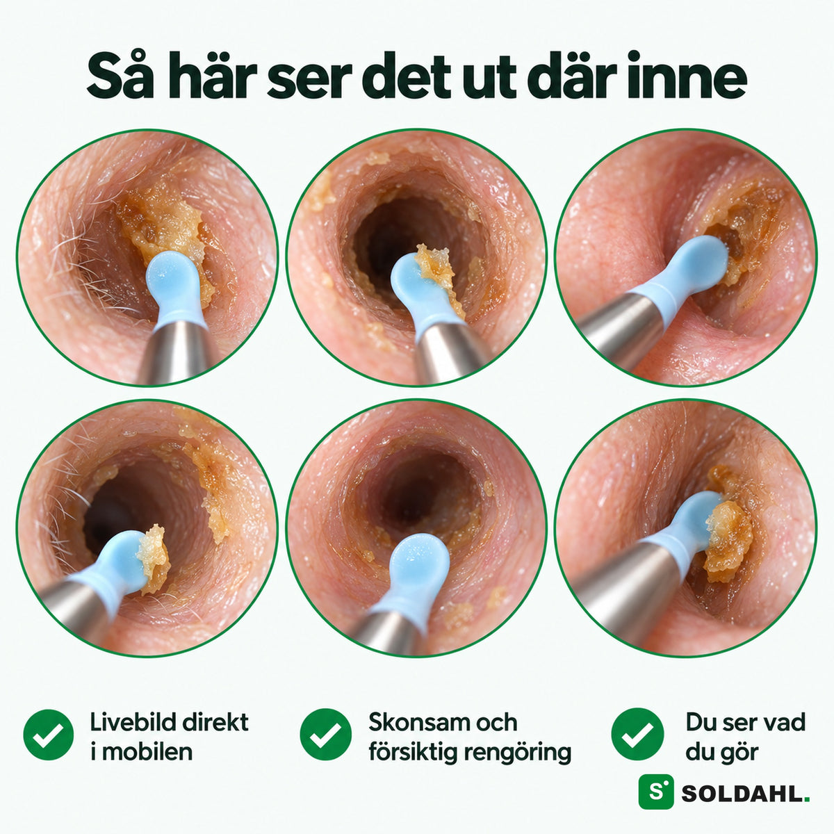 Så ser hörselgången ut i kamerans livebild