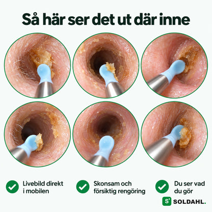 Så ser hörselgången ut i kamerans livebild