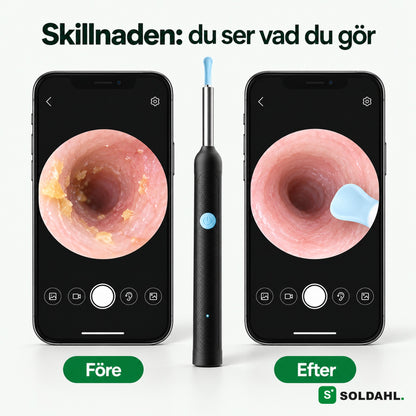 Före och efter i mobilens livebild